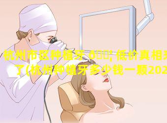 杭州市区种植牙 🐦 低价真相来了(杭州种植牙多少钱一颗2021)